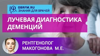 Рентгенолог Макогонова М.Е.: Лучевая диагностика деменций