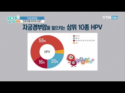 자궁경부암과 관련이 있는 인유두종 바이러스 - HPV 16, 18형 / YTN 라이프