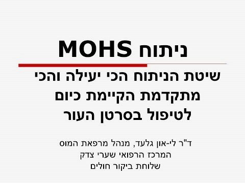 הרצאה על ניתוח מוז