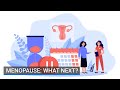 Menopause: What Next?