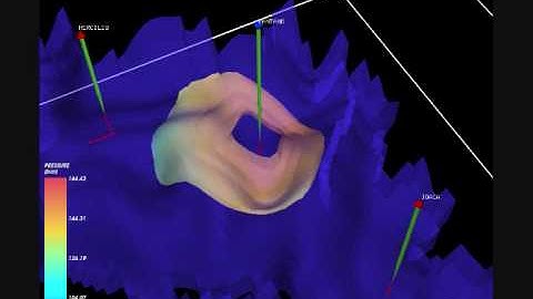 KRAKEN: Water Flooding