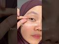 Your eyes need retinal👀 #dralthea #bloomers #darkcircles #eyeroller