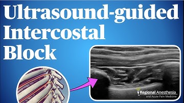 Ultrasound-Guided Intercostal Nerve Block