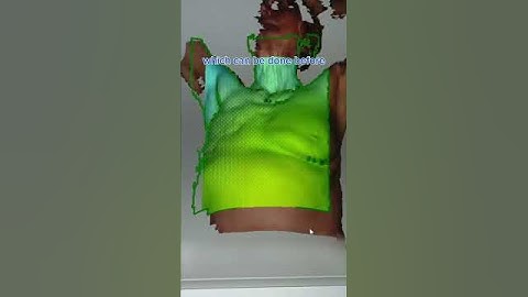 Revolutionary 3D-Customized Breast Prosthesis: Boosting Confidence After Mastectomy