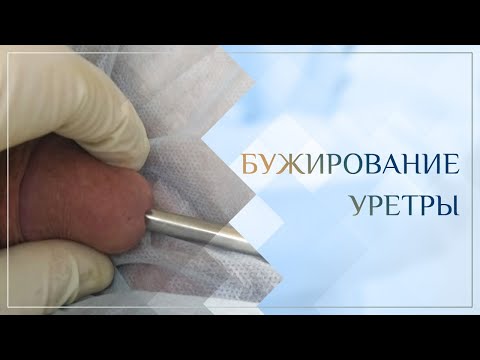 ? Бужирование уретры. Клинический случай №17