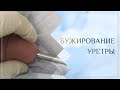 🚼 Бужирование уретры. Клинический случай №17