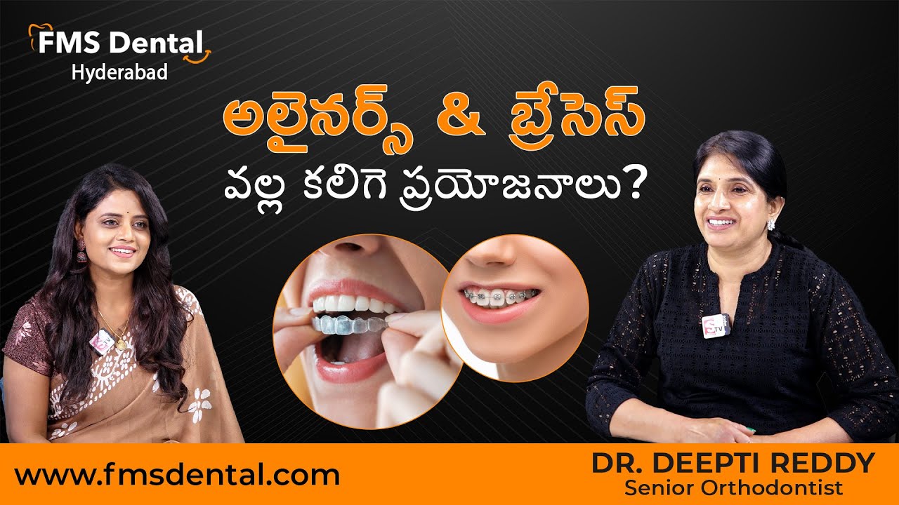 Uses of Aligners & Braces | Dr Deepthi Reddy | Senior Orthodontist ...