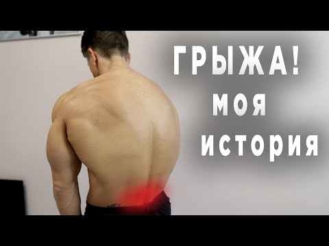 Обнаружили ПОЯСНИЧНУЮ ГРЫЖУ! Моя история + комплекс