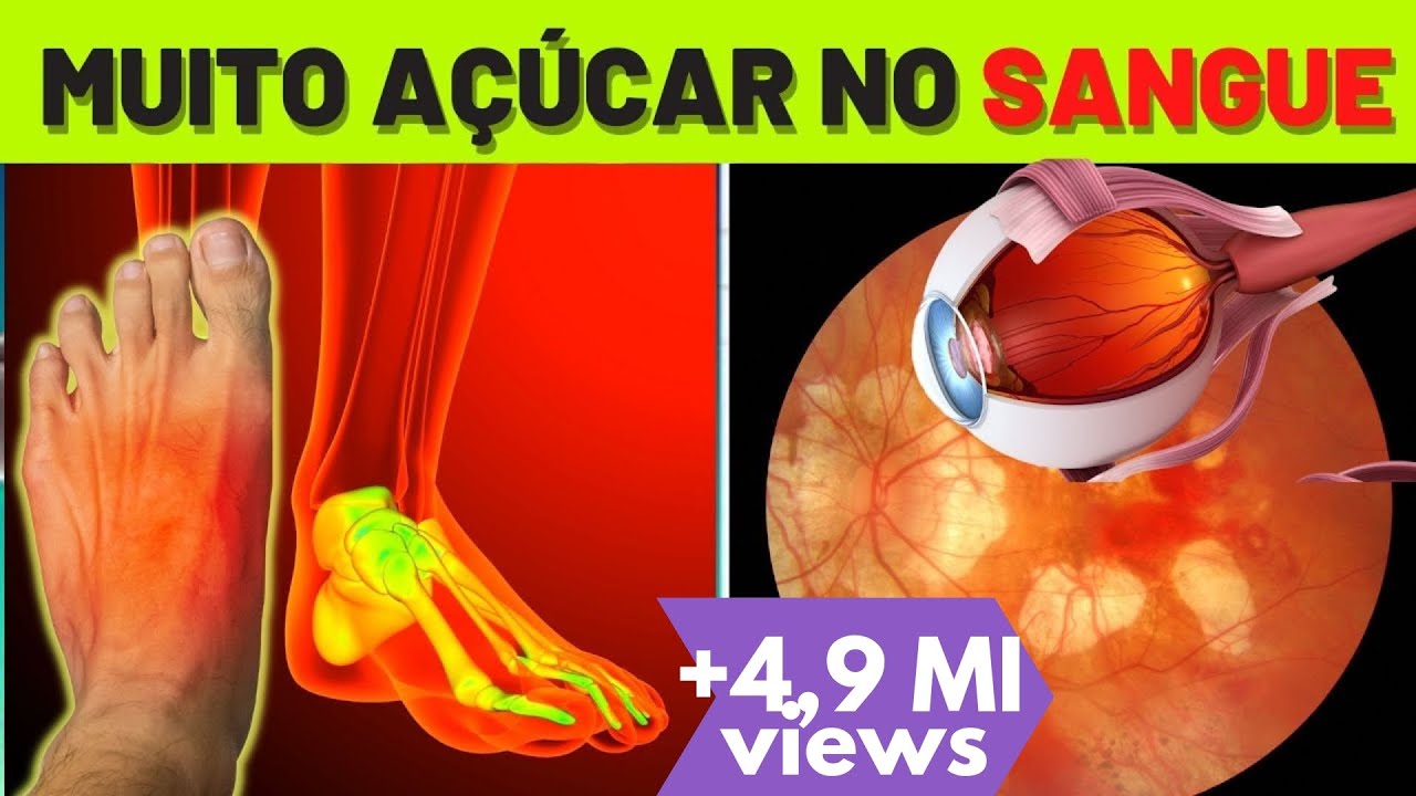 10 SINTOMAS INICIAIS de DIABETES (Que Você NÃO PODE IGNORAR) 10 SINTOMAS INICIAIS de DIABETES (Que Você NÃO PODE IGNORAR)