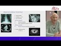 Replay  webcast marih  maladie de castleman  anatomopathologie