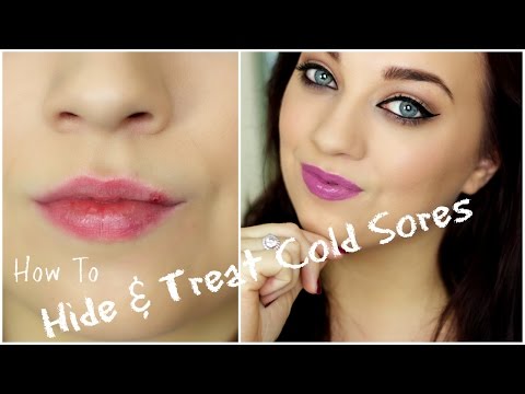How to: Treat & Hide Cold Sores | Tuesdays Beauty Tips