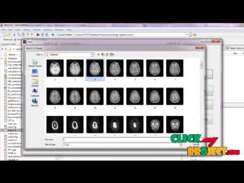 Final Year Projects | A Novel Medical Image Compression Using Ripplet transform