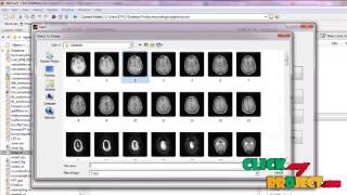 Final Year Projects | A Novel Medical Image Compression Using Ripplet transform