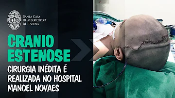 O que é uma cirurgia de craniossinostose?