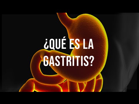 Todo sobre la Gastritis: Causas, Síntomas y Tratamiento con el Dr. Hugo Paredes