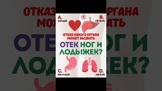 💧❤️ Отёки ног и лодыжек: сигнал о проблеме в организме #отеки #отекиног #отечность #здоровье