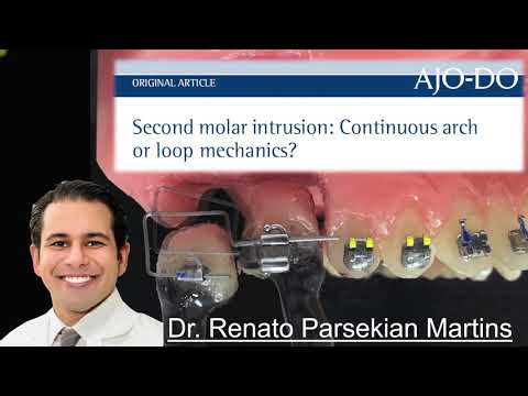 Second Molar Intrusion:  Continuous Arch or Loop Mechanics?