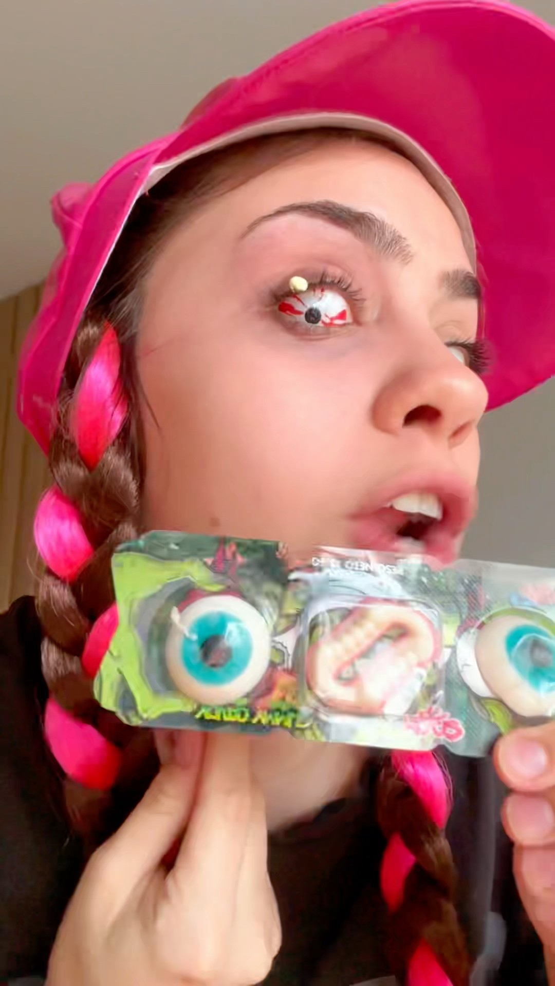 DULCES DE ELENITIS CONJUNTIVITIS