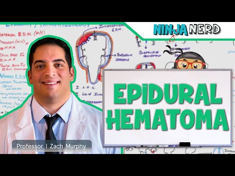 Video: Kdo dostane extradurální hematom?