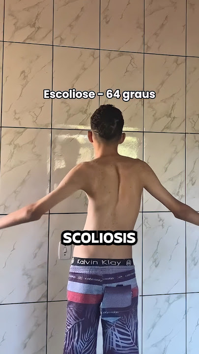 Incredible Gym Transformation! 💪 (@andre_firee)