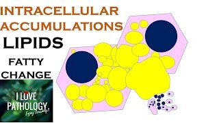 INTRACELLULAR ACCUMULATIONS: LIPIDS- Fatty Change