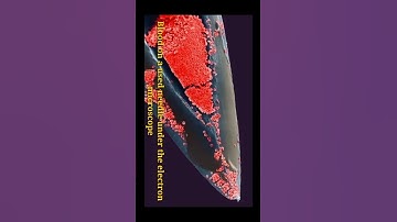 Normal and Microscopic view of the Needle.