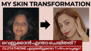 Skin Brightening|Skincare|My skin transformation|Glutathione ആവശ്യമുണ്ടോ |Malayalam#skinbrightening