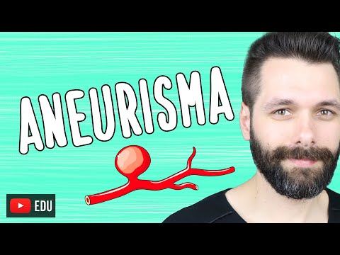 Video: È aneurisma o aneurisma?