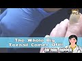 The Whole Big Toenail Comes Off!! | Did you see this?
