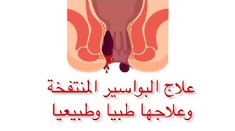 يوتيوب البواسير
