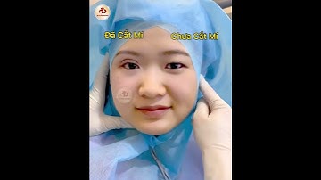 CẬN CẢNH 1 BÊN CẮT MÍ 1 BÊN CHƯA / Bác sỹ Tuấn Dương #shorts