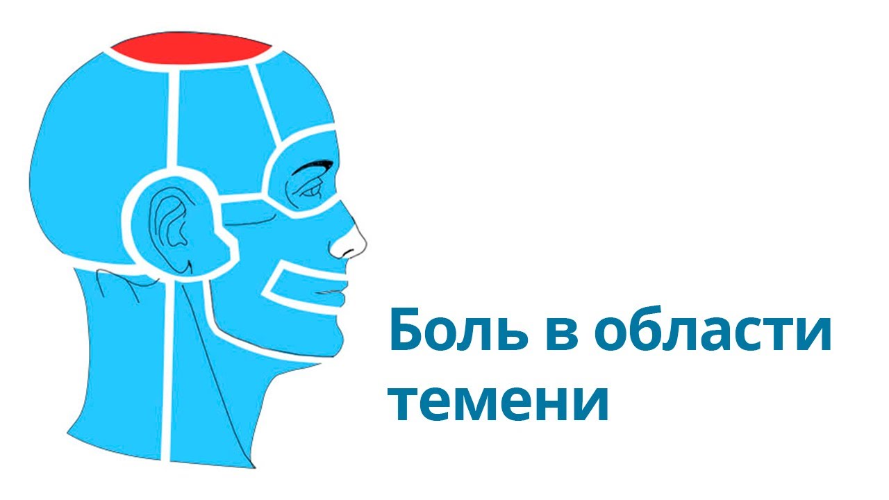 Болит темень. Головная боль локализация. Головная боль на макушке головы. Болит макушка головы. Болит макушка и затылок.