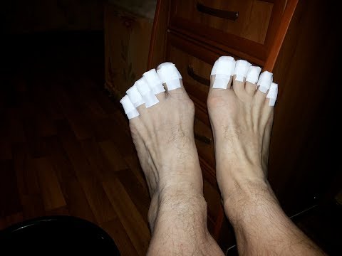 Лечение грибка ногтей ног лаком ОНИХЕЛП ч.1 Лечение грибка ногтей ног лаком ОНИХЕЛП ч.1