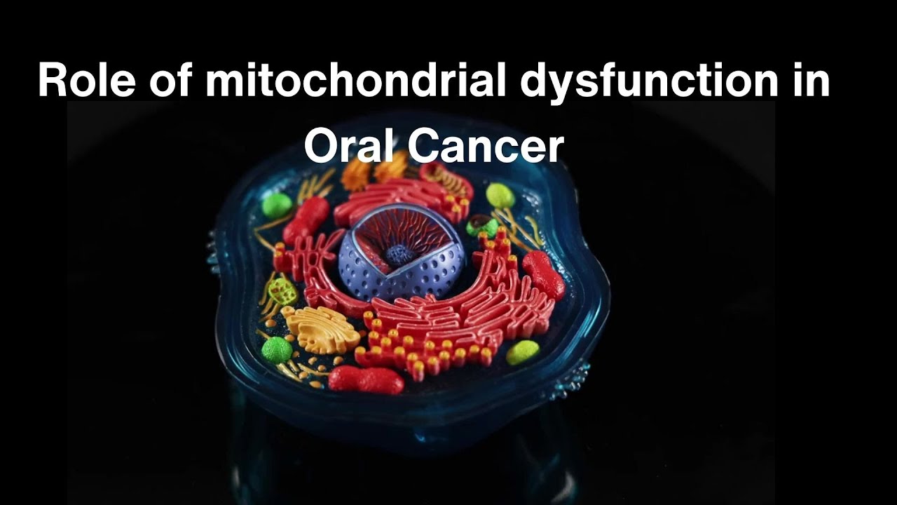 Role of mitochondrial dysfunction in Oral Cancer 