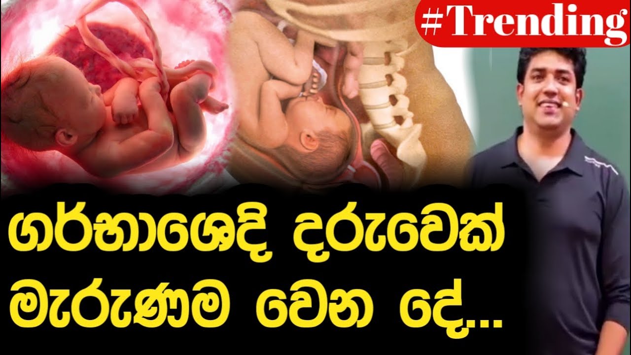 ගර්භාශෙදී දරුවෙක් මැරුණම වෙන දේ | Dinesh Muthugala | Episode 147
