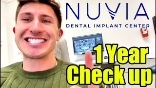 Full All on 4 - Full Mouth Dental Implant 1 Year Update Guide