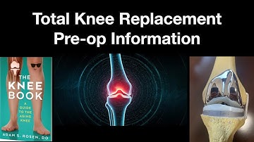 KNEE REPLACEMENT - Everything You NEED to Know