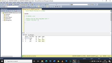 Use of DELETE Function of a ROW in SQL