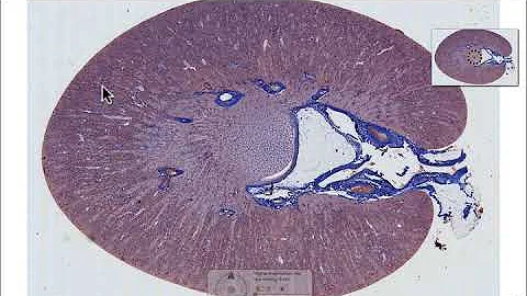 What your kidney looks like down the microscope