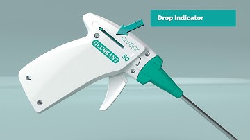 GLUTACK to fasten a-traumatically hernia meshes in abdominal surgery