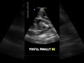 Pregnant Cat X-Ray and Ultrasound: Find Out How Many Kittens She’s Having!