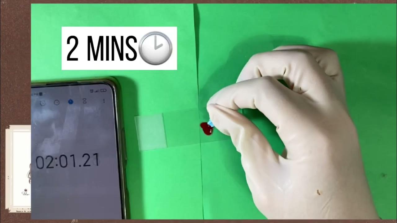 Clotting time (slide method) ) YouTube