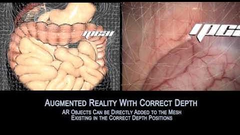 Monocular Laparosopic Scene 3D Surface Reconstruction and Augmented Reality based on Visual SLAM