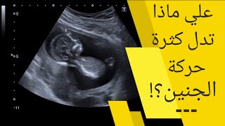 على ماذا تدل كثرة حركة الجنين | أسباب الحركة الزائدة للجنين | حركة الجنين الكثيرة على ماذا تدل