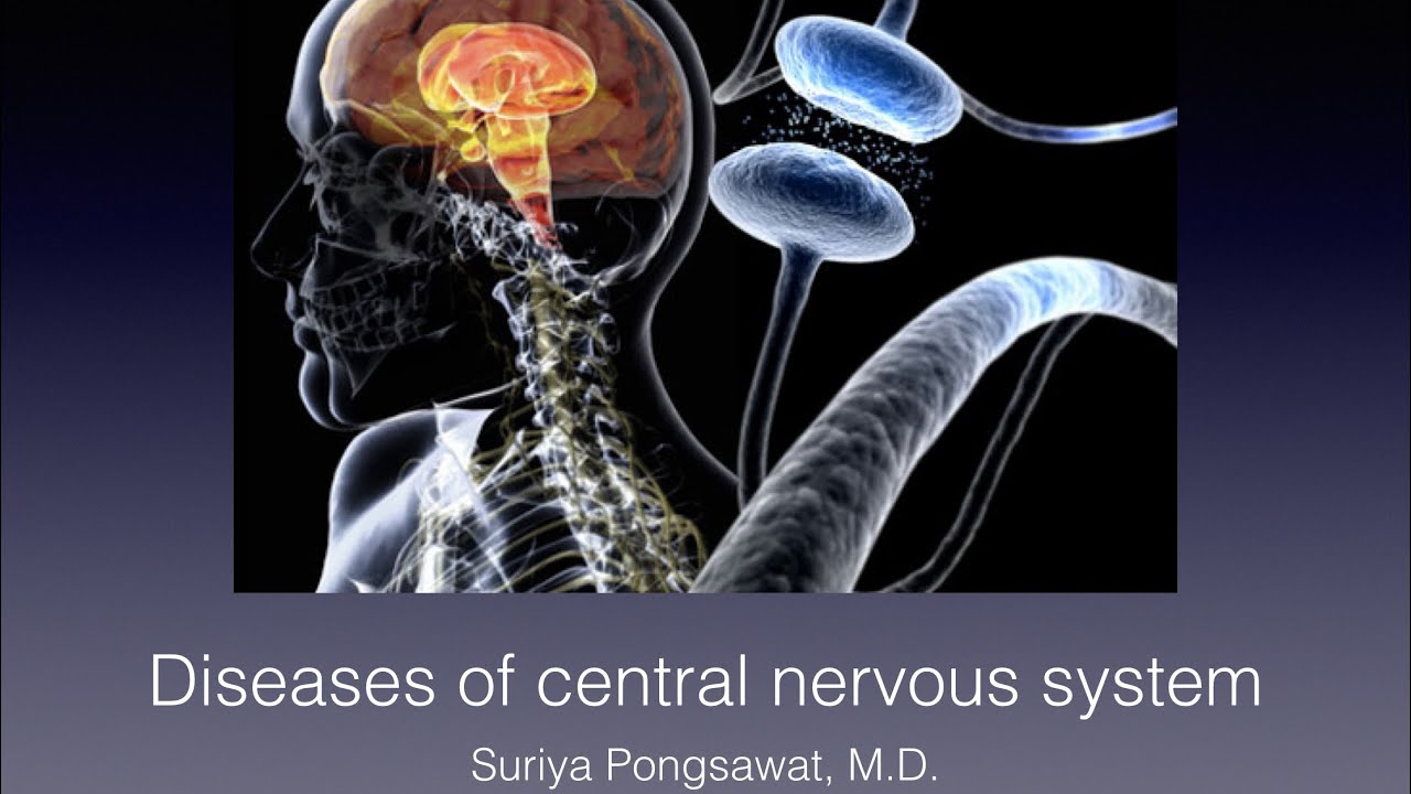 Diseases of CNS and PNS | pns คือเนื้อหาที่เกี่ยวข้องล่าสุด