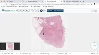 DP60 episode 3 pathpresenter high yield cases and navigating a slide