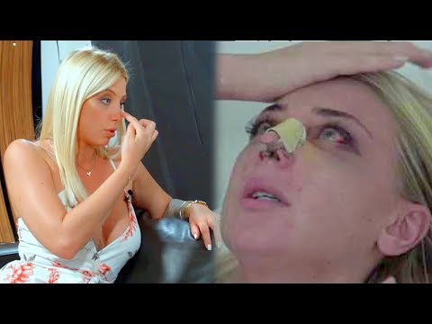 Vidéo: Samburskaya, Khilkevich Et D'autres Stars Qui Ont Prouvé Qu'ils Ne Pratiquaient Pas De Chirurgie Plastique