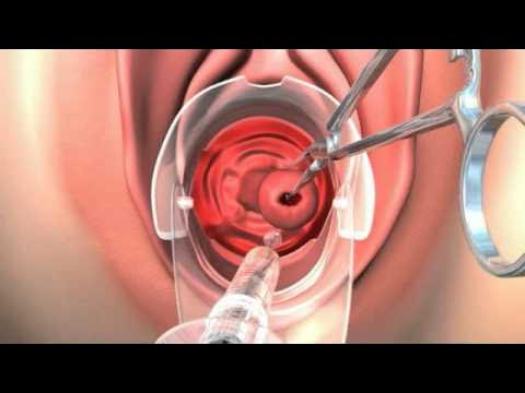 Жеке жыныстық қатынас