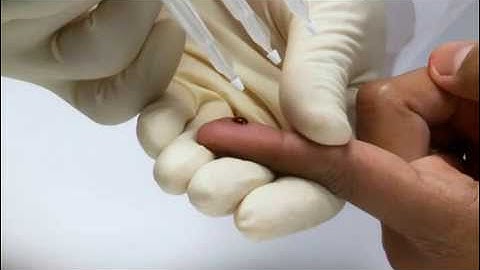 Remote Microsampling Technique | The Mitra Microsampler