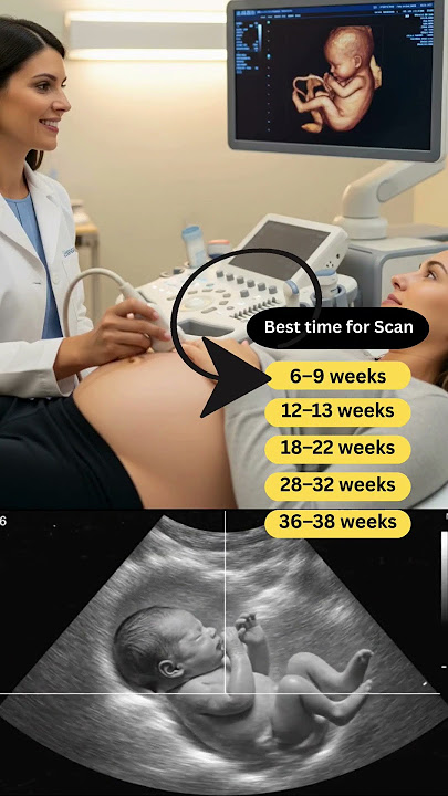 Best Time for Pregnancy Ultrasound Scan | Week-by-Week Guide